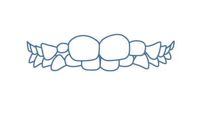 Dentes de leite e permanentes