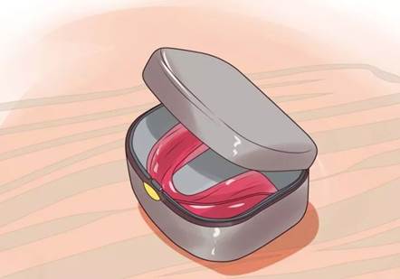 Manutenção Protetores Bucais